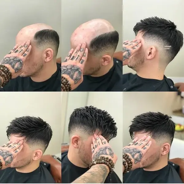 Antes y después de una prótesis capilar masculina con corte degradado, varias vistas