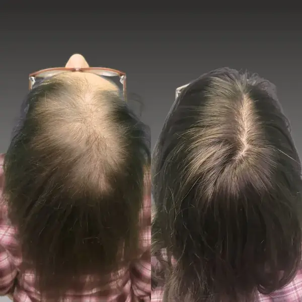 Antes y después de un topper femenino, vista superior
