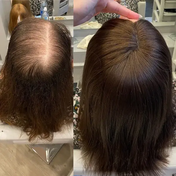 Antes y después de un topper femenino, vista superior
